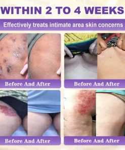 Evolvion® Biotin 10-in-1 Skin Restoration Cream