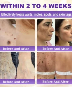 Evolvion® Biotin 10-in-1 Skin Restoration Cream