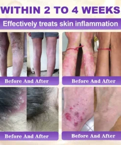 Evolvion® Biotin 10-in-1 Skin Restoration Cream