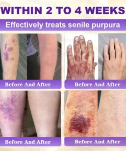 Evolvion® Biotin 10-in-1 Skin Restoration Cream