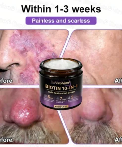 Evolvion® Biotin 10-in-1 Skin Restoration Cream