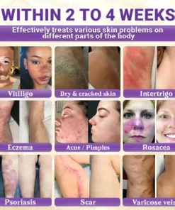 Evolvion® Biotin 10-in-1 All-in-One Barrier Repair Cream