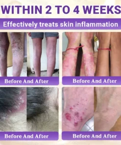 Evolvion® Biotin 10-in-1 All-in-One Barrier Repair Cream