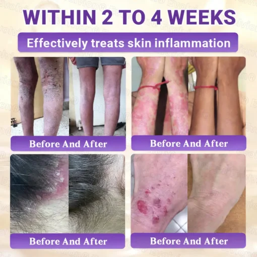 Evolvion® Biotin 10-in-1 All-in-One Barrier Repair Cream