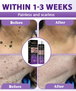 Evolvion® Biotin 10-in-1 Skin Restoration Spray