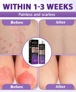 Evolvion® Biotin 10-in-1 Skin Restoration Spray