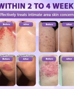Evolvion® Biotin 10-in-1 Skin Restoration Spray