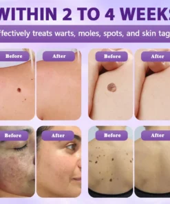 Evolvion® Biotin 10-in-1 Skin Restoration Spray