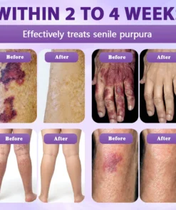 Evolvion® Biotin 10-in-1 Skin Restoration Spray