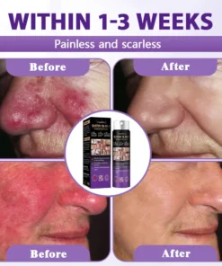 Evolvion® Biotin 10-in-1 Skin Restoration Spray