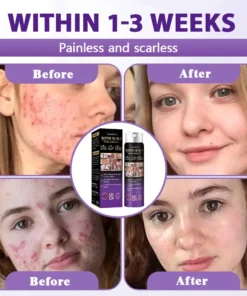 Evolvion® Biotin 10-in-1 Skin Restoration Spray