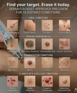 Evolvion® 𝟕-𝐃𝒂𝘆 𝐒𝗸𝐢𝐧 𝐓𝒂𝗴 & 𝐒𝐩𝙤𝐭 𝐄𝐫𝒂𝐬𝙚𝐫 Painless & Scar-Free Advanced Imperfection Remova𝗜 Ro𝗜𝗜erba𝗜𝗜 Pen