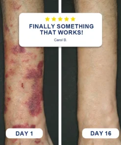 Evolvion® Bruise Care Balm