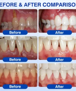 Evolvion® GumCare Pro Advanced Gum Care Gel