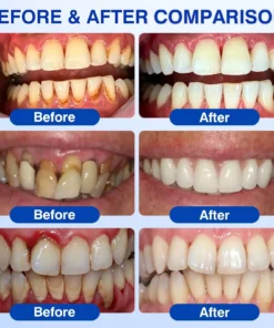 Evolvion® GumRevive Periodontal Repair Gel