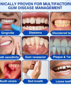 Evolvion® GumRevive Periodontal Repair Gel