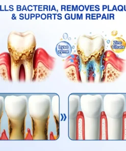 Evolvion® GumRevive Periodontal Repair Gel