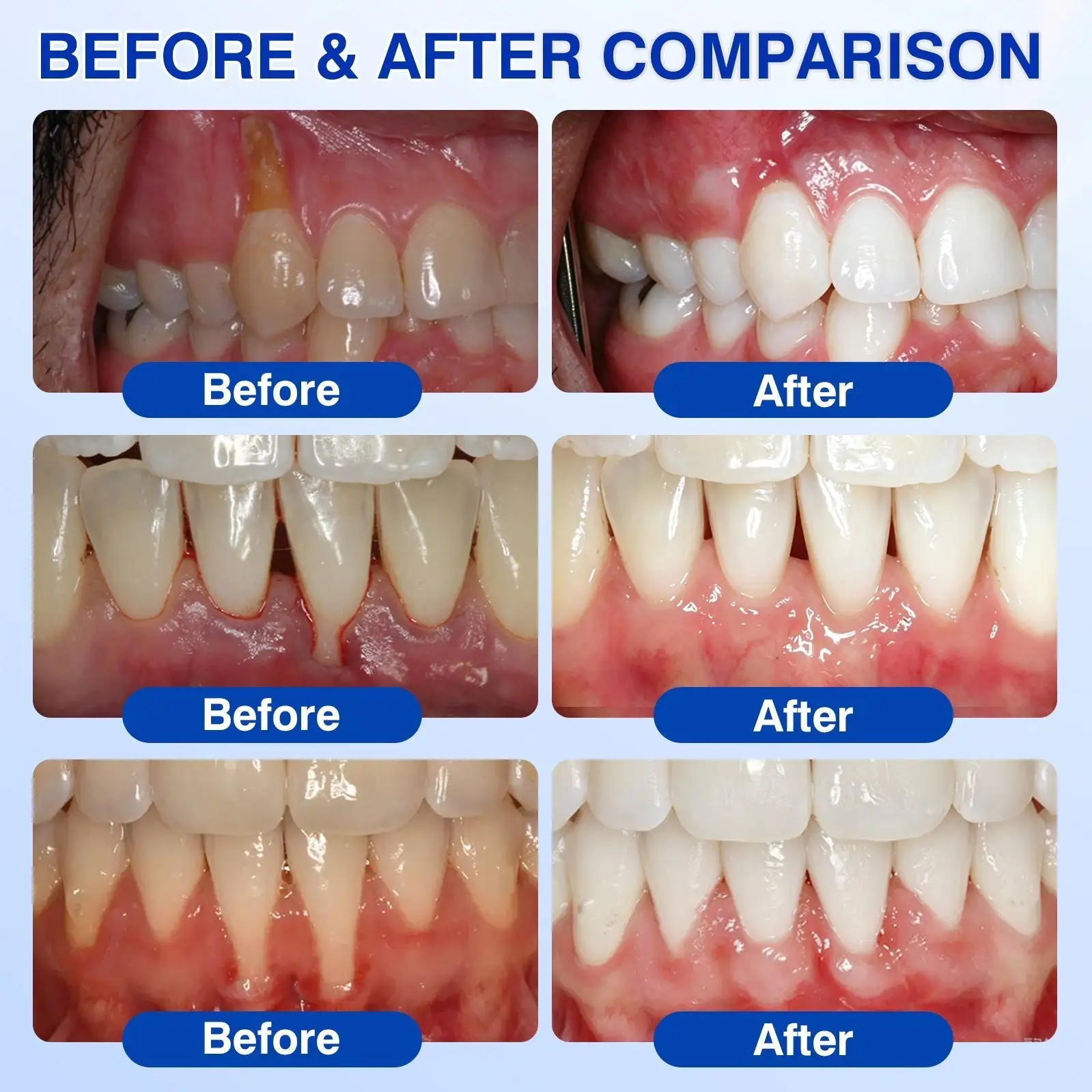 Evolvion® GumVital Advanced Gum Care Gel