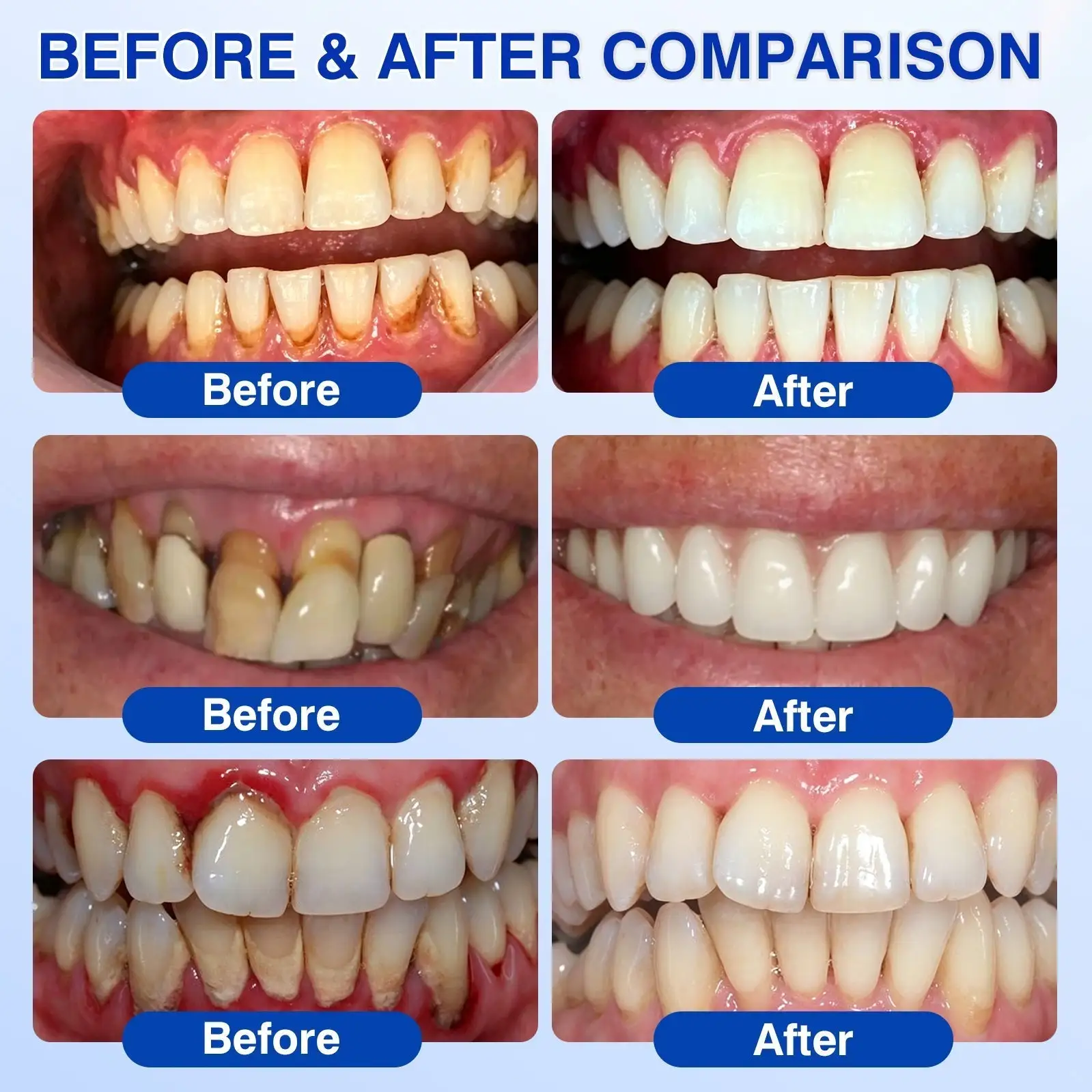 Evolvion® GumVital Advanced Gum Care Gel