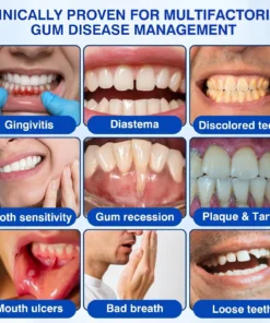 Evolvion® GumVital Advanced Gum Care Gel
