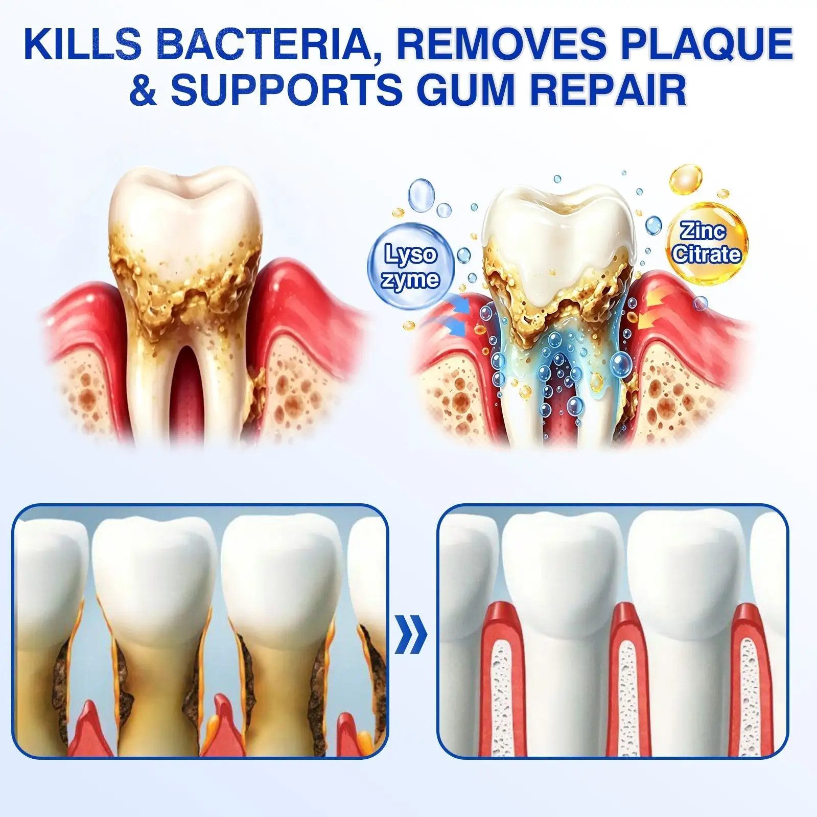 Evolvion® GumVital Advanced Gum Care Gel