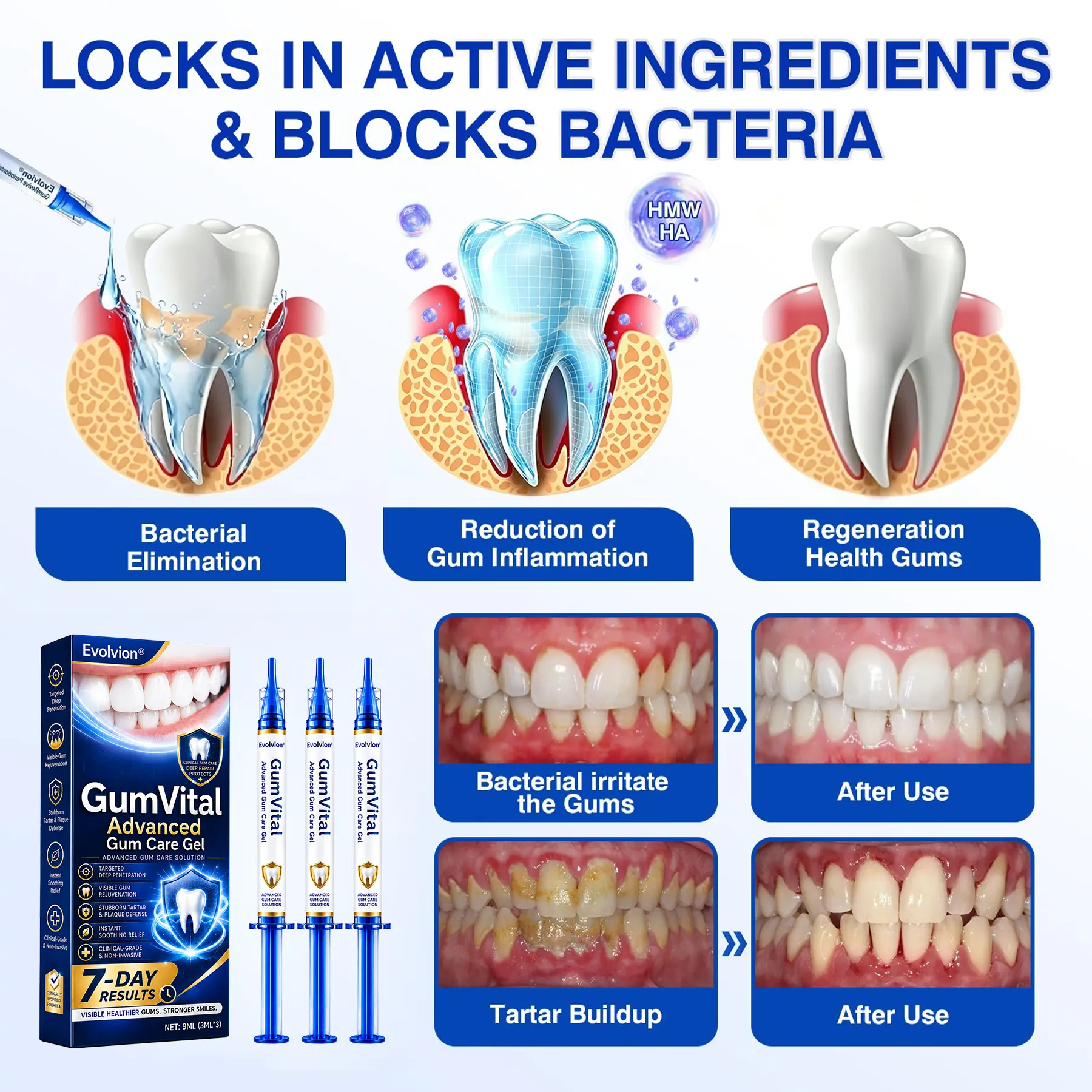 Evolvion® GumVital Advanced Gum Care Gel