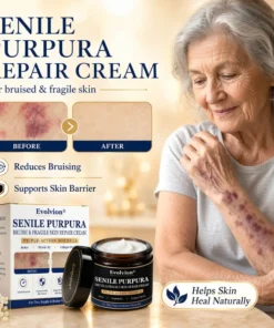 Evolvion® Senile Purpura, Bruise & Fragile Skin Repair Cream