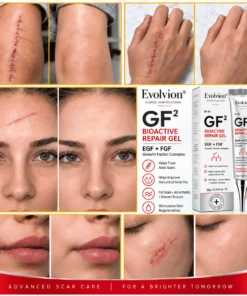Evolviion GF² Advanced Bioactive Scar Repair Gel
