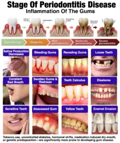 Evolvion® Bee Venom Gingivitis & Periodontitis Treatment Toothpaste