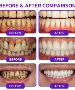 Evolvion® Bee Venom Gingivitis & Periodontitis Treatment Toothpaste