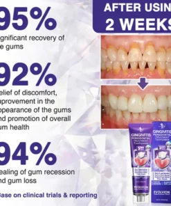 Evolvion® Bee Venom Gingivitis & Periodontitis Treatment Toothpaste